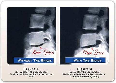 DDS Double Lite Lumbar Decompression Belt